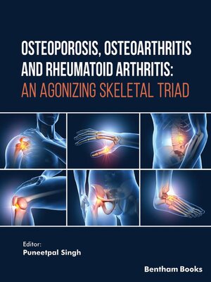 cover image of Osteoporosis, Osteoarthritis and Rheumatoid Arthritis